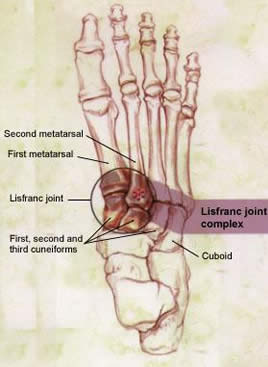 Lisfranc Joint Complex