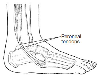 Foot and Ankle Conditions | Peroneal Tendons