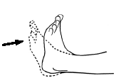 Restore Normal Ankle Function