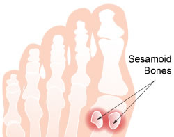 Sesamoid Bones diagram