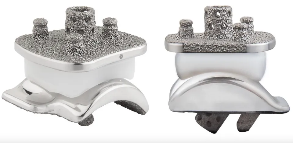 Vantage Total Ankle Replacement